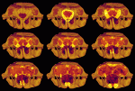 Nine successive digital slices through the front portion of the skull of Kryptobataar, displaying large sinus cavities and remnants of the turbinates, which were present in life but subsequently were broken during fossilization. (Sample courtesy of Dr. Guillermo Rougier, American Museum of Natural History)