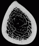 Single slice of a chimpanzee tibia, showing the relationship between the thick outer bone and the delicate internal structures. (Sample courtesy of Dr. John Kappelman, University of Texas at Austin).