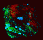 3D reconstruction of a portion of a diamondiferous eclogite from Udachnaya, Yakutia. Matrix of partially altered clinopyroxene has been rendered transparent; large porphyroblasts of garnet are semi-transparent red; diamonds are opaque blue, and alteration zones through the sample (along which the diamonds tend to align) are bright green.