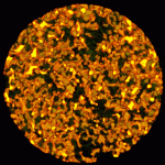A pseudocolored 3D reconstruction of 100 7.5 micron scans of an 1/8" core of sandstone impregnated with Woods metal, looking down through the top of the core. Sandstone matrix (green) has been rendered mostly transparent. Distribution of metal (yellow) defines the porosity. (Sample courtesy of Sid Green, Terratek and Dr. Larry Myer, Lawrence Berkeley National Laboratory)