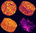 High-resolution industrial X-ray CT is capable of producing detailed 3D imagery of asphalt concrete. The upper four images are from sample 11-2; 64 mm high, 145 mm in diameter. Image (top left) is a single CT slice. Image (top right) is a complete 3D volume rendering of the entire dataset collected for the core. In image (bottom left) the asphalt (purple/red) is rendered transparent, displaying only the aggregates. By inverting the grayscale of image (bottom right) so that the void spaces appeared violet/salmon, and rendering both the aggregate and asphalt mastic transparent, the connectivity of the void network can be seen.