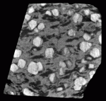 Single scan of a migmatitic garnet-amphibolite. Edge length of sample is 45 mm. Garnets are lightest, while melanosome appears gray and leucosomes appear darkest. Sample courtesy of Mary Ann Brown and Dr. Michael Brown, University of Maryland.